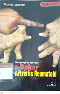 Mengungkap tentang luka bakar dan artritis reumatoid