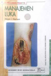 Manajemen luka