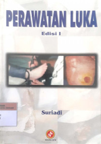 Perawatan luka